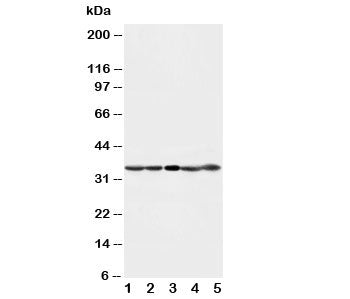 Western blot testing of CDK1 antibody and Lane 1: HeLa; 2: 293T; 3: A431; 4: CEM; 5: Jurkat cell lys