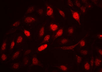 Cyclin A2 Antibody / CCNA2