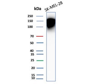 Western blot testing of human SK-MEL-28 cell lysate with CD66a antibody (clone CEACAM1/12661). Predi