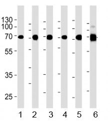 Acetylcholinesterase Antibody / ACHE