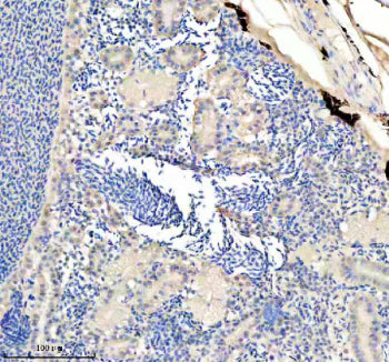 IHC staining of FFPE zebrafish kidney tissue with Zebrafish Eno1 antibody, HRP secondary and DAB sub