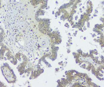 GNAQ Antibody / Guanine nucleotide binding protein Gq subunit alpha, 100ug