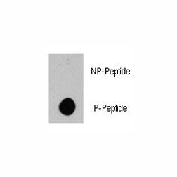 Dot blot analysis of phospho-BRAF antibody. 50ng of phos-peptide or nonphos-peptide per dot were spo