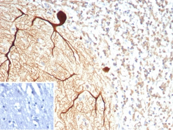 CA8 Antibody / Carbonic Anhydrase VIII