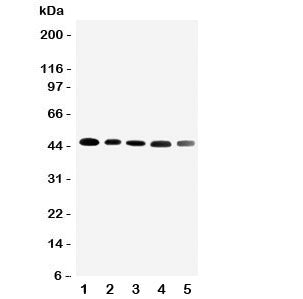 CBG Antibody Cortisol Binding Globulin