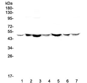 Western blot testing of human 1) HeLa, 2) placenta, 3) A549, 4) MDA-MB-453, 5) SW620, 6) 22RV1 and 7