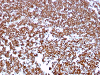 IHC staining of FFPE human tonsil tissue with CD20 antibody (clone MS4A1/3409). HIER: boil tissue se