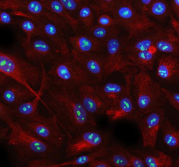Immunofluorescent staining of AATF using anti-AATF antibody (green) and anti-Beta Tubulin antibody (