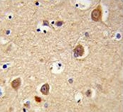 AIFM1 Antibody / AIF / Apoptosis-Inducing Factor
