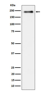 Western blot analysis of Phospho-LRP6 (S1490) expression in lysate from human HeLa cells treated wit