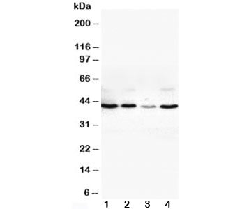 Western blot testing of VEGFD antibody and Lane 1: SW620; 2: COLO320; 3: 6T-CEM; 4: HT1080 cell lysa