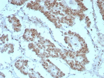 IHC staining of FFPE human prostate tissue with BAF47 antibody (clone rINI1/8850) HIER: boil tissue 