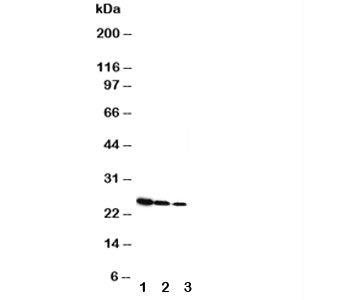 Western blot testing of Growth Hormone antibody and Lane 1: Recombinant rat GH protein 10ng; 2: 5ng;