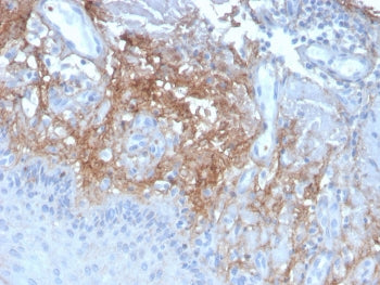 IHC staining of FFPE human skin with Decorin antibody (clone DCN/3523). HIER: boil tissue sections i