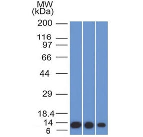Western blot testing of human 1) HeLa, 2) A549 and 3) A431 cell lysate with S100A4 antibody (clone S