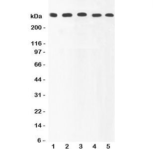 Ki67 Antibody