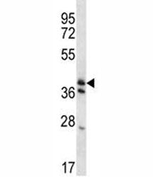 KLF2 antibody western blot analysis in mouse heart tissue lysate. Predicted molecular weight ~38 kDa