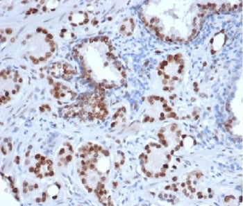 Androgen Receptor Antibody