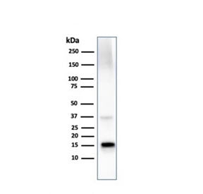 TTR Antibody / Transthyretin / Prealbumin