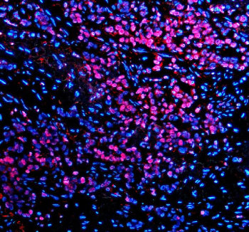 TBX5 Antibody / T-box protein 5, 100ug