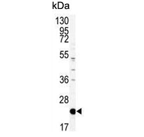 Western blot testing of mouse NIH 3T3 cell lysate with Phosphatidylethanolamine-binding protein 1 an