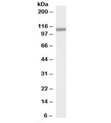 Western blot testing of human pancreas lysate with SMEK1 antibody at 0.3ug/ml. Predicted molecular w