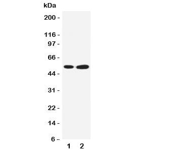 Western blot testing of SBP antibody and Lane 1: COLO320; 2: PANC cell lysate