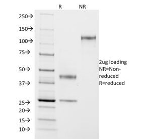 ASRGL1 Antibody / ALP1