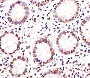 MGMT Antibody