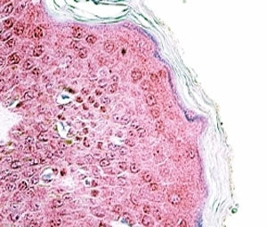 IHC staining of FFPE human skin with TRIM29 antibody at 4ug/ml. HIER: steamed with pH6 citrate buffe