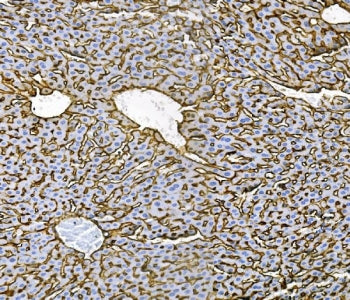 IHC staining of FFPE mouse spleen with Cd81 antibody. HIER: boil tissue sections in pH8 EDTA buffer 