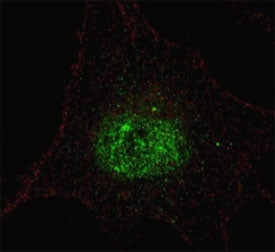 Fluorescent confocal image of SY5Y cells stained with phospho-PDX1 antibody. Alexa Fluor 488 conjuga