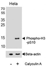 Western blot analysis of lysate from HeLa cell line, untreated or treated with Calyculin A (100ng/ml