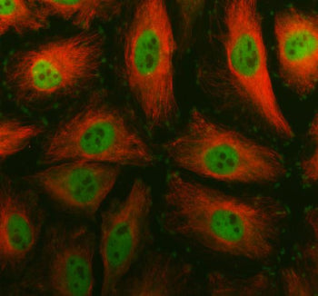 Immunofluorescent staining of FFPE human HeLa cells with SMC4 antibody (green) and Alpha Tubulin mAb