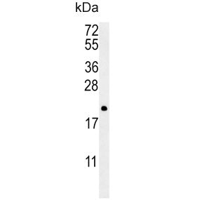 Western blot testing of human NCI-H460 cell lysate with PTP4A2 antibody. Predicted molecular weight 