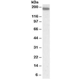 Western blot testing of human spleen lysate with LFA-1 antibody at 0.5ug/ml. Predicted molecular wei