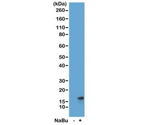 Western blot of acid extracts from HeLa cells untreated (-) or treated (+) with sodium butyrate usin