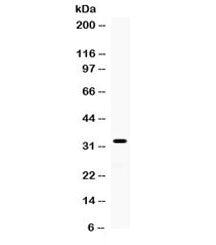 TREX1 Antibody