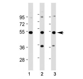 Western blot testing of STK25 antibody at 1:2000: Lane 1) human A431 cell lysate, 2) human HepG2 cel