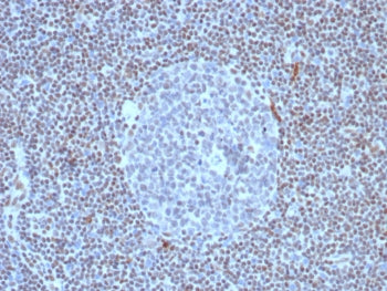 IHC staining of FFPE human lymph node tissue with recombinant FLI1 antibody (clone FLI1/8318R). HIER