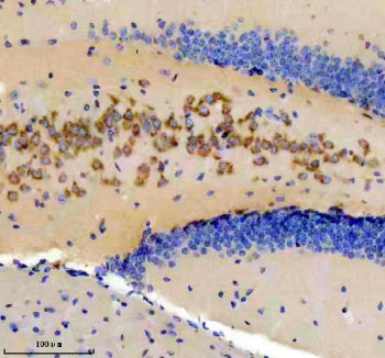 DKK3 Antibody / Dickkopf-related protein 3, 100ul