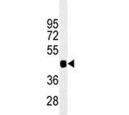 PAX6 Antibody, 0.4ml