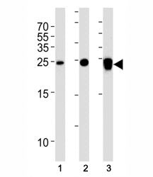 UCHL1 Antibody