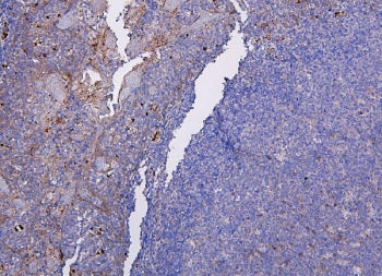 IHC staining of FFPE human tonsil tissue with CXCR2 antibody. HIER: boil tissue sections in pH8 EDTA