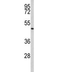 ACR Antibody / Acrosin