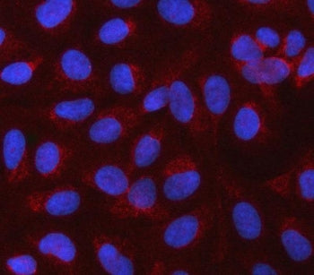 CBLIF Antibody / Cobalamin binding intrinsic factor / GIF