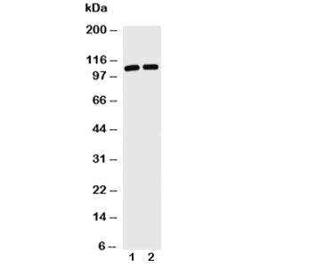 Western blot with TRIF antibody and Lane 1: Jurkat; 2: HL-60 cell lysate. Predicted/observed molecul
