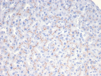 IHC staining of FFPE human liver tissue with BSEP antibody (clone BSEP/7534). HIER: boil tissue sect