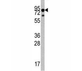 Western blot analysis of TrkA antibody and mouse liver tissue lysate. Observed molecular weight: 85~