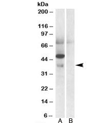 Western blot testing of human placenta lysate with Apolipoprotein L4 antibody at 0.5ug/ml with [B] a